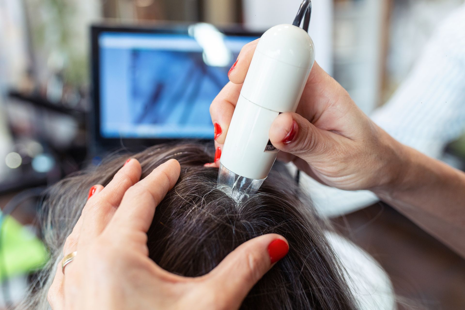 Close-up scalp analysis during a trichology examination